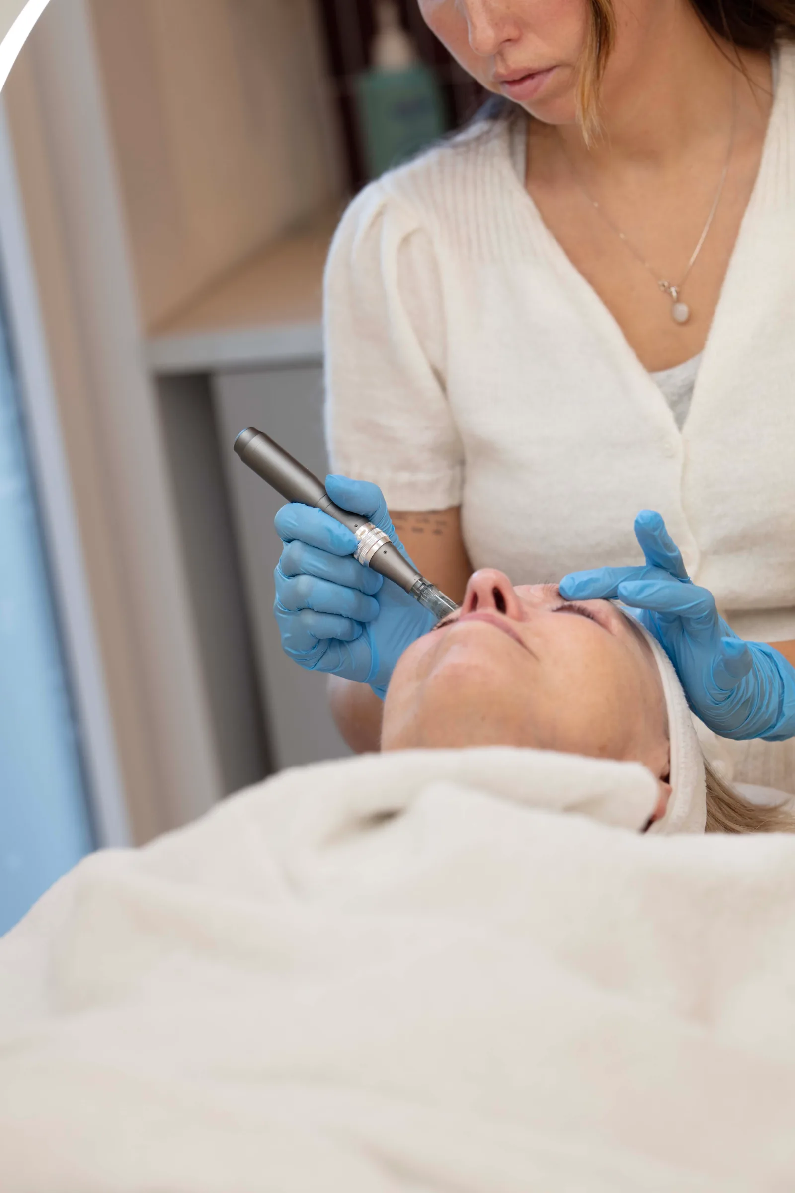 Microneedling in Huidpraktijk Rhoon