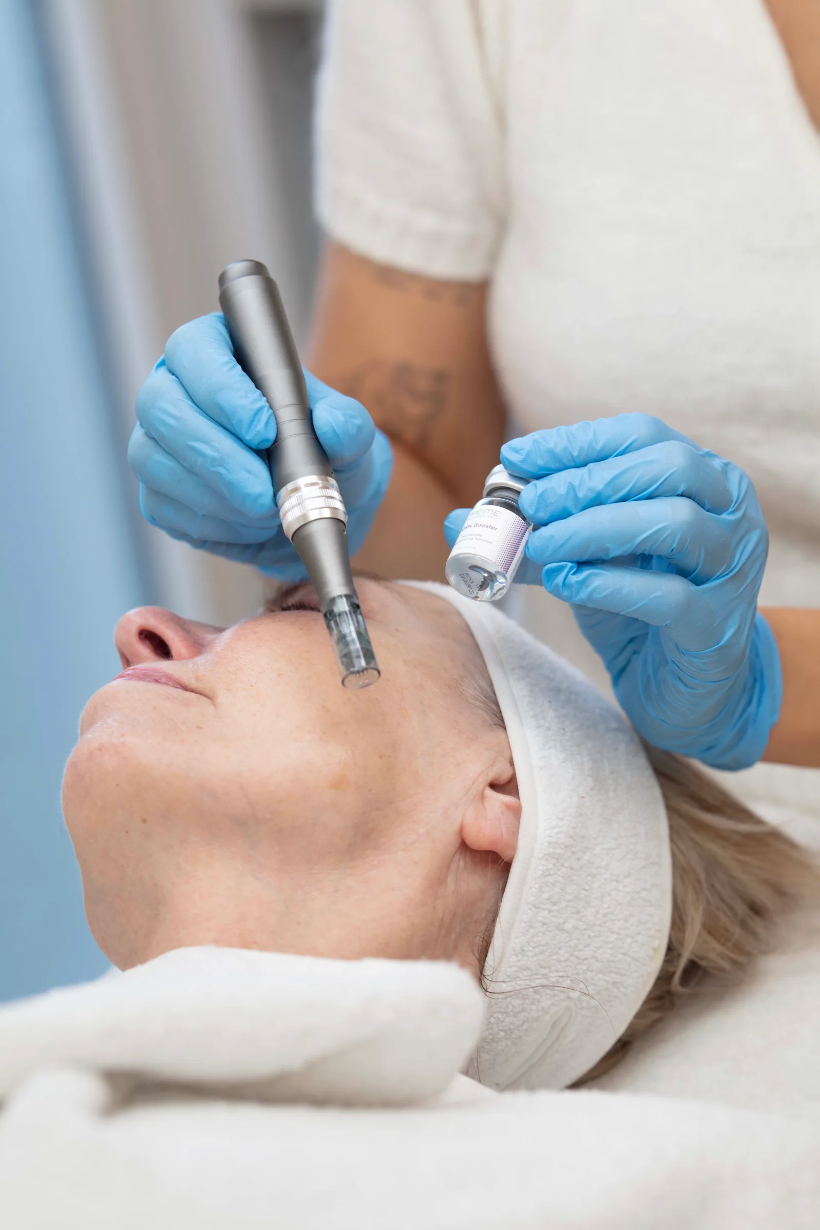 Microneedling met Zalm-DNA